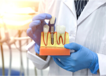 implants tlc treatment dictionary richmond tlc dentists