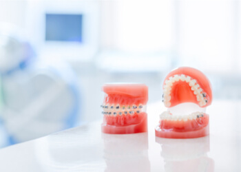 orthodontics tlc treatment dictionary richmond tlc dentists