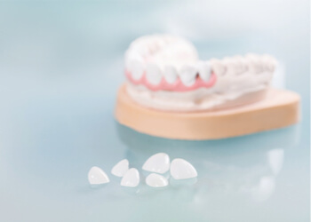 veneers tlc treatment dictionary richmond tlc dentists
